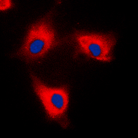 YWHAQ / 14-3-3 Theta Antibody - Immunofluorescent analysis of 14-3-3 theta/tau staining in HeLa cells. Formalin-fixed cells were permeabilized with 0.1% Triton X-100 in TBS for 5-10 minutes and blocked with 3% BSA-PBS for 30 minutes at room temperature. Cells were probed with the primary antibody in 3% BSA-PBS and incubated overnight at 4 C in a humidified chamber. Cells were washed with PBST and incubated with a DyLight 594-conjugated secondary antibody (red) in PBS at room temperature in the dark. DAPI was used to stain the cell nuclei (blue).