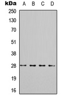 YWHAQ / 14-3-3 Theta Antibody - Western blot analysis of 14-3-3 theta/tau (pS232) expression in A549 (A); A431 (B); HEK293T (C); mouse brain (D) whole cell lysates.