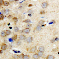 YWHAQ / 14-3-3 Theta Antibody - Immunohistochemical analysis of 14-3-3 theta/tau (pS232) staining in human brain formalin fixed paraffin embedded tissue section. The section was pre-treated using heat mediated antigen retrieval with sodium citrate buffer (pH 6.0). The section was then incubated with the antibody at room temperature and detected using an HRP conjugated compact polymer system. DAB was used as the chromogen. The section was then counterstained with hematoxylin and mounted with DPX.