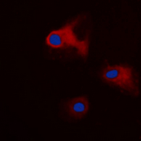 YWHAQ / 14-3-3 Theta Antibody - Immunofluorescent analysis of 14-3-3 theta/tau (pS232) staining in A549 cells. Formalin-fixed cells were permeabilized with 0.1% Triton X-100 in TBS for 5-10 minutes and blocked with 3% BSA-PBS for 30 minutes at room temperature. Cells were probed with the primary antibody in 3% BSA-PBS and incubated overnight at 4 deg C in a humidified chamber. Cells were washed with PBST and incubated with a DyLight 594-conjugated secondary antibody (red) in PBS at room temperature in the dark. DAPI was used to stain the cell nuclei (blue).