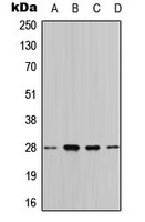 YWHAQ / 14-3-3 Theta Antibody - Western blot analysis of 14-3-3 theta expression in HeLa (A); MCF7 (B); SP2/0 (C); rat liver (D) whole cell lysates.
