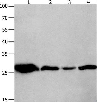 YWHAQ / 14-3-3 Theta Antibody - Western blot analysis of Mouse brain tissue, A549 cell and human lymphoma tissue, HeLa cell, using YWHAQ Polyclonal Antibody at dilution of 1:950.