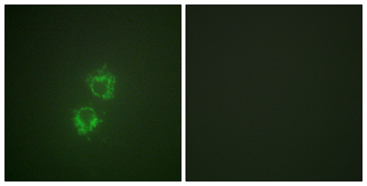 YWHAQ / 14-3-3 Theta Antibody - Immunofluorescence analysis of HeLa cells, using 14-3-3 thet/tau (Phospho-Ser232) Antibody. The picture on the right is blocked with the phospho peptide.