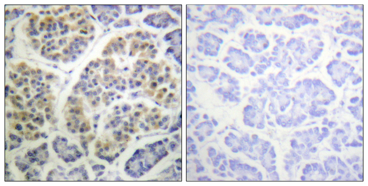 YWHAQ / 14-3-3 Theta Antibody - Immunohistochemistry analysis of paraffin-embedded human pancreas, using 14-3-3 thet/tau (Phospho-Ser232) Antibody. The picture on the right is blocked with the phospho peptide.
