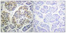 YWHAQ / 14-3-3 Theta Antibody - Immunohistochemistry analysis of paraffin-embedded human pancreas, using 14-3-3 thet/tau (Phospho-Ser232) Antibody. The picture on the right is blocked with the phospho peptide.