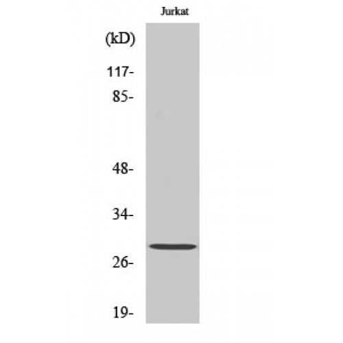 YWHAZ / 14-3-3 Zeta Antibody - Western blot of Phospho-14-3-3 zeta (S58) antibody