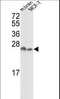 YWHAZ / 14-3-3 Zeta Antibody - Western blot of hYWHAZ-D231 in mouse brain tissue and MCF-7 cell line lysates (35 ug/lane). YWHAZ (arrow) was detected using the purified antibody.