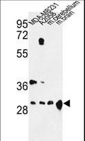 YWHAZ / 14-3-3 Zeta Antibody - Western blot of YWHAZ Antibody in MDA-MB231, A2058 cell line and mouse cerebellum, brain tissue lysates (35 ug/lane). YWHAZ (arrow) was detected using the purified antibody.