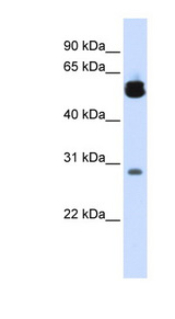 YWHAZ / 14-3-3 Zeta Antibody - YWHAZ / 14-3-3 Zeta Delta antibody Western blot of Fetal Lung lysate. This image was taken for the unconjugated form of this product. Other forms have not been tested.
