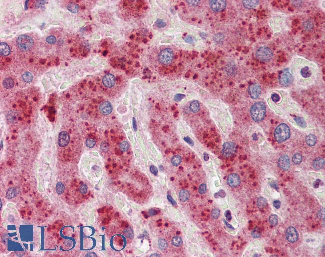 YWHAZ / 14-3-3 Zeta Antibody - Anti-YWHAZ / 14-3-3 Zeta Delta antibody IHC of human liver. Immunohistochemistry of formalin-fixed, paraffin-embedded tissue after heat-induced antigen retrieval. Antibody concentration 5 ug/ml.  This image was taken for the unconjugated form of this product. Other forms have not been tested.