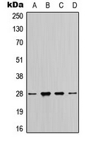 YWHAZ / 14-3-3 Zeta Antibody - Western blot analysis of 14-3-3 zeta expression in MCF7 (A); HeLa (B); SP2/0 (C); H9C2 (D) whole cell lysates.