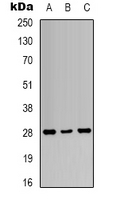 YWHAZ / 14-3-3 Zeta Antibody - Western blot analysis of 14-3-3 zeta (pT232) expression in A431 UV-treated (A); K562 UV-treated (B); NIH3T3 UV-treated (C) whole cell lysates.