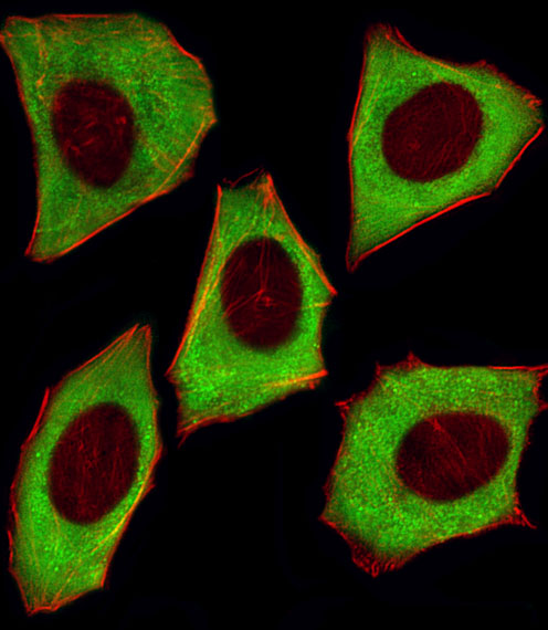 YWHAZ / 14-3-3 Zeta Antibody - Fluorescent image of U251 cells stained with YWHAZ Antibody. Antibody was diluted at 1:25 dilution. An Alexa Fluor 488-conjugated goat anti-mouse lgG at 1:400 dilution was used as the secondary antibody (green). Cytoplasmic actin was counterstained with Alexa Fluor 555 conjugated with Phalloidin (red).