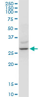 YWHAZ / 14-3-3 Zeta Antibody - YWHAZ monoclonal antibody (M04), clone 1B3. Western Blot analysis of YWHAZ expression in human kidney.