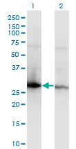 YWHAZ / 14-3-3 Zeta Antibody - Western Blot analysis of YWHAZ expression in transfected 293T cell line by YWHAZ monoclonal antibody (M04), clone 1B3.Lane 1: YWHAZ transfected lysate(27.7 KDa).Lane 2: Non-transfected lysate.