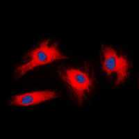 YWHAZ / 14-3-3 Zeta Antibody - Immunofluorescent analysis of 14-3-3 zeta staining in HeLa cells. Formalin-fixed cells were permeabilized with 0.1% Triton X-100 in TBS for 5-10 minutes and blocked with 3% BSA-PBS for 30 minutes at room temperature. Cells were probed with the primary antibody in 3% BSA-PBS and incubated overnight at 4 C in a humidified chamber. Cells were washed with PBST and incubated with a DyLight 594-conjugated secondary antibody (red) in PBS at room temperature in the dark. DAPI was used to stain the cell nuclei (blue).