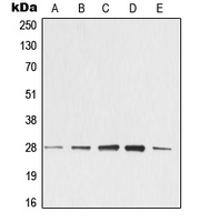 YWHAZ / 14-3-3 Zeta Antibody - Western blot analysis of 14-3-3 zeta expression in KNRK (A); NIH3T3 (B); C4 (C); EOC20 (D); CTLL2 (E) whole cell lysates.