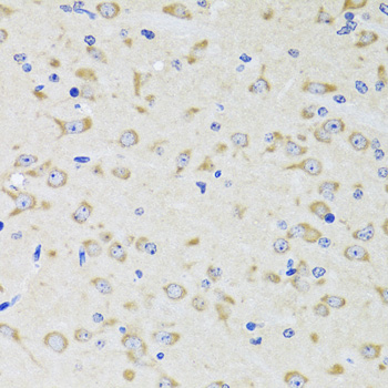 YWHAZ / 14-3-3 Zeta Antibody - Immunohistochemistry of paraffin-embedded rat brain tissue.