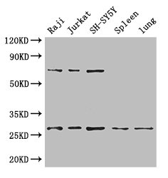 YWHAZ / 14-3-3 Zeta Antibody - Positive WB detected in:Raji whole cell lysate,Jurkat whole cell lysate,SH-SY5Y whole cell lysate,Mouse spleen tissue,Mouse lung tissue;All lanes: YWHAZ antibody at 3.4ug/ml;Secondary;Goat polyclonal to rabbit IgG at 1/50000 dilution;Predicted band size: 28,20 kDa;Observed band size: 28,70 kDa;
