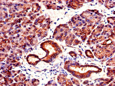 YWHAZ / 14-3-3 Zeta Antibody - IHC image of YWHAZ Antibody diluted at 1:1000 and staining in paraffin-embedded human pancreatic tissue performed on a Leica BondTM system. After dewaxing and hydration, antigen retrieval was mediated by high pressure in a citrate buffer (pH 6.0). Section was blocked with 10% normal goat serum 30min at RT. Then primary antibody (1% BSA) was incubated at 4°C overnight. The primary is detected by a biotinylated secondary antibody and visualized using an HRP conjugated SP system.
