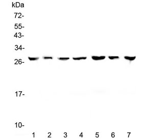 YWHAZ / 14-3-3 Zeta Antibody - Western blot testing of human 1) HeLa, 2) placenta, 3) HepG2, 4) A549, 5) PANC-1, 6) SK-OV-3 and 7) 22RV1 lysate with 14-3-3 zeta antibody at 0.5ug/ml. Predicted molecular weight ~28 kDa.