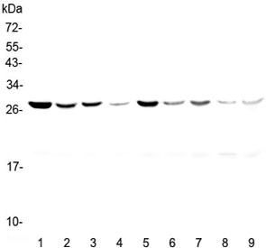 YWHAZ / 14-3-3 Zeta Antibody - Western blot testing of rat 1) brain, 2) spleen, 3) lung, 4) liver and mouse 5) brain, 6) spleen, 7) lung, 8) liver and 9) kidney lysate with 14-3-3 zeta antibody at 0.5ug/ml. Predicted molecular weight ~28 kDa.