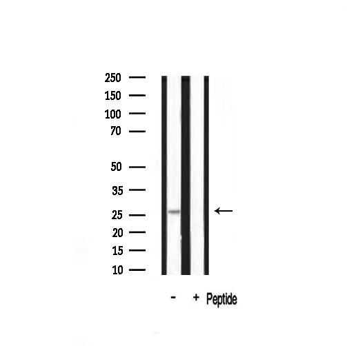 YWHAZ / 14-3-3 Zeta Antibody - Western blot analysis on mouse brain lysate using 14-3-3 beta/? antibody. The lane on the right is treated with the antigen-specific peptide.