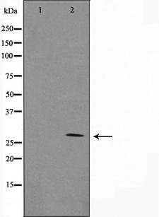YWHAZ / 14-3-3 Zeta Antibody - Western blot analysis on RAW264.7 cell lysates using 14-3-3 beta/? antibody. The lane on the left is treated with the antigen-specific peptide.