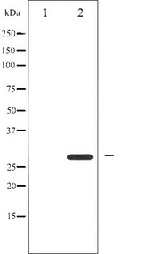 YWHAZ / 14-3-3 Zeta Antibody - Western blot analysis of 14-3-3 zeta expression in Forskolin treated 293 whole cells lysates. The lane on the left is treated with the antigen-specific peptide.