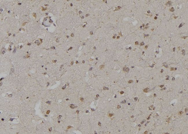 YWHAZ / 14-3-3 Zeta Antibody - 1:100 staining human brain tissue by IHC-P. The sample was formaldehyde fixed and a heat mediated antigen retrieval step in citrate buffer was performed. The sample was then blocked and incubated with the antibody for 1.5 hours at 22°C. An HRP conjugated goat anti-rabbit antibody was used as the secondary.