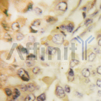 YWHAZ / 14-3-3 Zeta Antibody - 1/100 staining human liver tissue by IHC-P. The sample was formaldehyde fixed and a heat mediated antigen retrieval step in citrate buffer was performed. The sample was then blocked and incubated with the antibody for 1.5 hours at 22°C. An HRP conjugated goat anti-rabbit antibody was used as the secondary antibody.