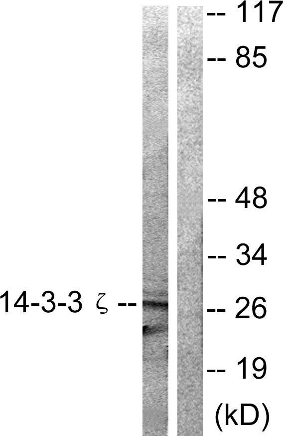 YWHAZ / 14-3-3 Zeta Antibody - Western blot analysis of extracts from 293 cells treated with Forskolin (40nM, 30min) using 14-3-3 ? (Ab-58) antibody ( Line1 and 2).