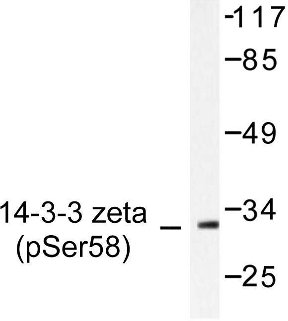 YWHAZ / 14-3-3 Zeta Antibody - Western blot of p-14-3-3 zeta (S58) pAb in extracts from Jurkat cells treated with Insulin.