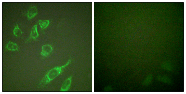 YWHAZ / 14-3-3 Zeta Antibody - Immunofluorescence analysis of HeLa cells treated with PMA 125ng/ml 30', using 14-3-3 zeta (Phospho-Ser58) Antibody. The picture on the right is blocked with the phospho peptide.