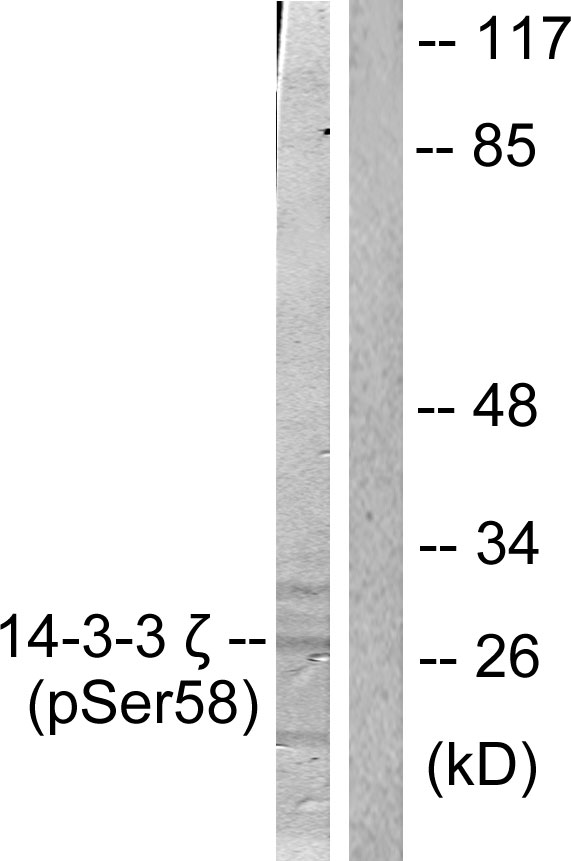 YWHAZ / 14-3-3 Zeta Antibody - Western blot analysis of lysates from NIH/3T3 cells treated with UV 30', using 14-3-3 zeta (Phospho-Ser58) Antibody. The lane on the right is blocked with the phospho peptide.