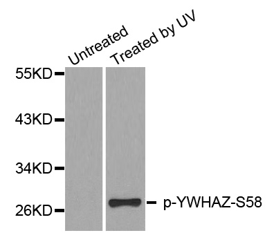 YWHAZ / 14-3-3 Zeta Antibody - Western blot analysis of extracts from Hela cells.