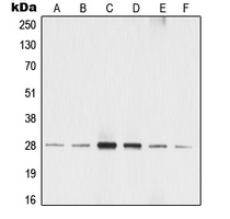 YWHAZ / 14-3-3 Zeta Antibody - Western blot analysis of 14-3-3 zeta (pS58) expression in MCF7 (A); A549 (B); SP2/0 (C); rat liver (D); NIH3T3 (E); A431 (F) whole cell lysates.