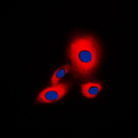 YWHAZ / 14-3-3 Zeta Antibody - Immunofluorescent analysis of 14-3-3 zeta (pS58) staining in A549 cells. Formalin-fixed cells were permeabilized with 0.1% Triton X-100 in TBS for 5-10 minutes and blocked with 3% BSA-PBS for 30 minutes at room temperature. Cells were probed with the primary antibody in 3% BSA-PBS and incubated overnight at 4 C in a humidified chamber. Cells were washed with PBST and incubated with a DyLight 594-conjugated secondary antibody (red) in PBS at room temperature in the dark. DAPI was used to stain the cell nuclei (blue).