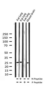 YWHAZ / 14-3-3 Zeta Antibody - Western blot analysis of Phospho-14-3-3 zeta (Ser58) expression in various lysates