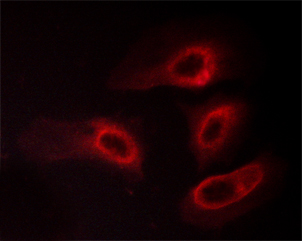YWHAZ / 14-3-3 Zeta Antibody - Staining HeLa cells treated with PMA 125ng/ml 30' cells by IF/ICC. The samples were fixed with PFA and permeabilized in 0.1% saponin prior to blocking in 10% serum for 45 min at 37°C. The primary antibody was diluted 1/400 and incubated with the sample for 1 hour at 37°C. A Alexa Fluor 594 conjugated goat polyclonal to rabbit IgG (H+L), diluted 1/600 was used as secondary antibody.