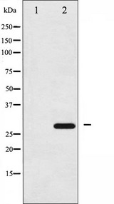 YWHAZ / 14-3-3 Zeta Antibody - Western blot analysis of 14-3-3 zeta phosphorylation expression in UV treated NIH-3T3 whole cells lysates. The lane on the left is treated with the antigen-specific peptide.