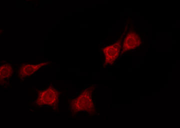 YWHAZ / 14-3-3 Zeta Antibody - Staining NIH-3T3 cells by IF/ICC. The samples were fixed with PFA and permeabilized in 0.1% Triton X-100, then blocked in 10% serum for 45 min at 25°C. The primary antibody was diluted at 1:200 and incubated with the sample for 1 hour at 37°C. An Alexa Fluor 594 conjugated goat anti-rabbit IgG (H+L) Ab, diluted at 1/600, was used as the secondary antibody.