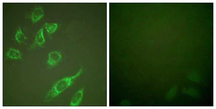 YWHAZ / 14-3-3 Zeta Antibody - PMA + - Immunofluorescence analysis of HeLa cells, treated with PMA (125ng/ml, 30mins), using 14-3-3 ? (phospho-Ser58) antibody.