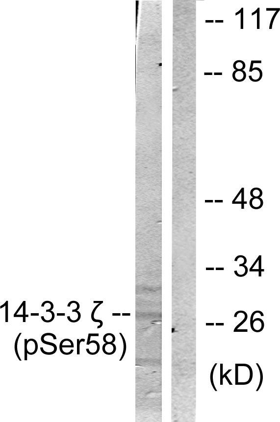 YWHAZ / 14-3-3 Zeta Antibody - Western blot analysis of extracts from NIH/3T3 cells treated with UV (30mins), using 14-3-3 ? (phospho-Ser58) antibody.