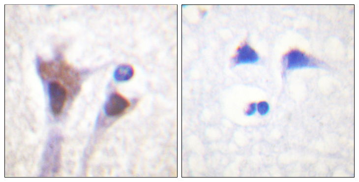 YWHAZ / 14-3-3 Zeta Antibody - Immunohistochemistry analysis of paraffin-embedded human brain, using 14-3-3 zeta/delta (Phospho-Thr232) Antibody. The picture on the right is blocked with the phospho peptide.