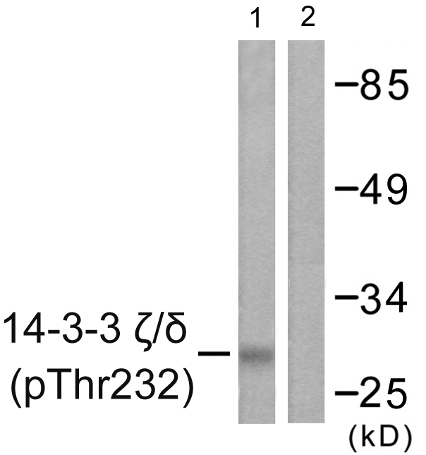 YWHAZ / 14-3-3 Zeta Antibody - Western blot analysis of lysates from Jurkat cells treated with UV 15', using 14-3-3 zeta/delta (Phospho-Thr232) Antibody. The lane on the right is blocked with the phospho peptide.