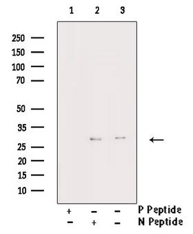 YWHAZ / 14-3-3 Zeta Antibody - Western blot analysis of Phospho-14-3-3 zeta/delta (Thr232) antibody expression in UV treated Jurkat cells lysates. The lane on the right is treated with the antigen-specific peptide.