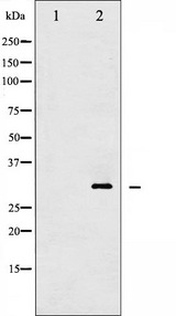 YWHAZ / 14-3-3 Zeta Antibody - Western blot analysis of 14-3-3 zeta/delta phosphorylation expression in UV treated Jurkat whole cells lysates. The lane on the left is treated with the antigen-specific peptide.
