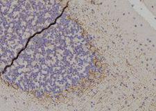 YWHAZ / 14-3-3 Zeta Antibody - 1:100 staining rat brain tissue by IHC-P. The sample was formaldehyde fixed and a heat mediated antigen retrieval step in citrate buffer was performed. The sample was then blocked and incubated with the antibody for 1.5 hours at 22°C. An HRP conjugated goat anti-rabbit antibody was used as the secondary.