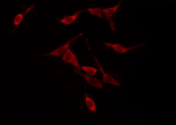 YWHAZ / 14-3-3 Zeta Antibody - Staining NIH-3T3 cells by IF/ICC. The samples were fixed with PFA and permeabilized in 0.1% Triton X-100, then blocked in 10% serum for 45 min at 25°C. The primary antibody was diluted at 1:200 and incubated with the sample for 1 hour at 37°C. An Alexa Fluor 594 conjugated goat anti-rabbit IgG (H+L) Ab, diluted at 1/600, was used as the secondary antibody.